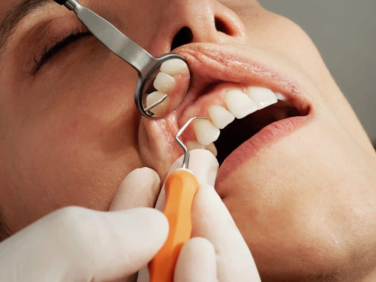 Everything You Need To Know About Dental Hygienists